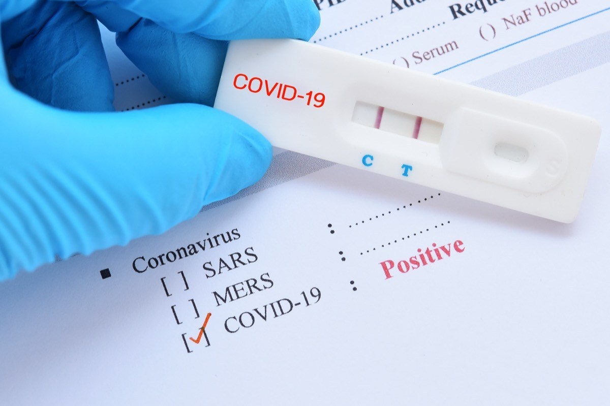 covid-coronavirus-test-positive_tazb.jpg